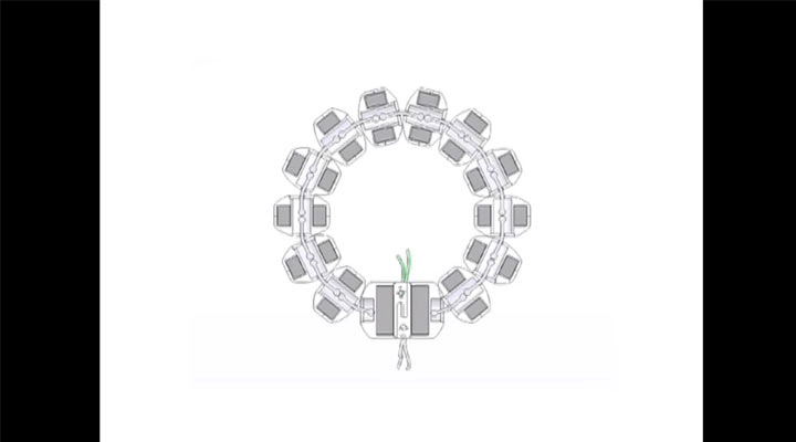 Magnetic Sphincter for Gastroesophageal Reflux Disease