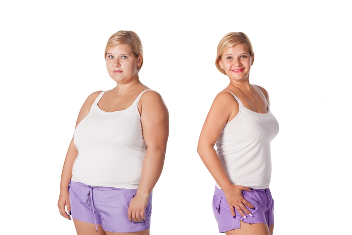 Bariatric Surgery for Obese Teens