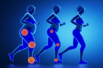 Bariatric Surgeon for Obesity Bariatric Surgeon for Obesity