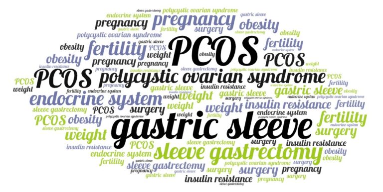 PCOS Gastric Sleeve