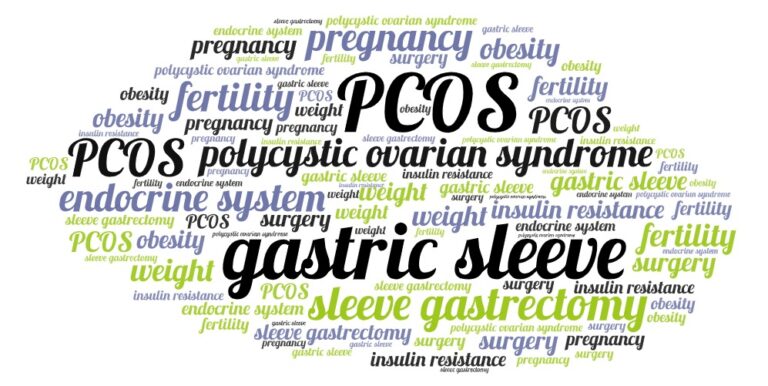 Gastric Sleeve and PCOS