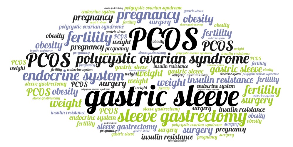 PCOS Gastric Sleeve