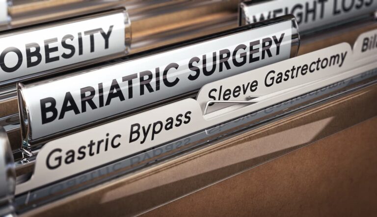 Weight Loss surgery