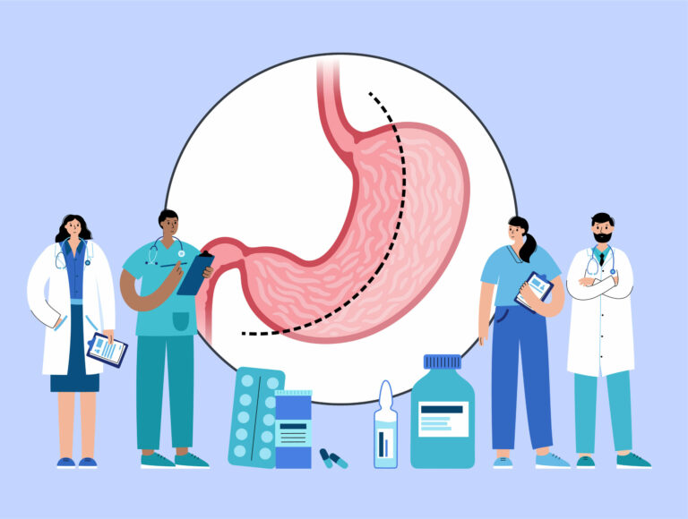 Bariatric Surgery