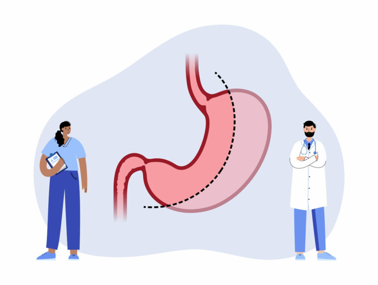 Bariatric Surgery & Diabetes - cartoonish image of two medical professionals standing on either side of a drawing of the stomach and intestines.