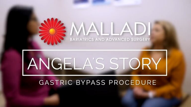 Angela’s Story – Gastric Bypass