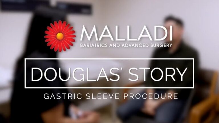 Douglas’s Story – Gastric Sleeve Patient