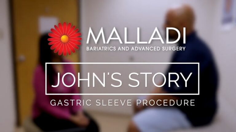 John’s Story – Gastric Sleeve