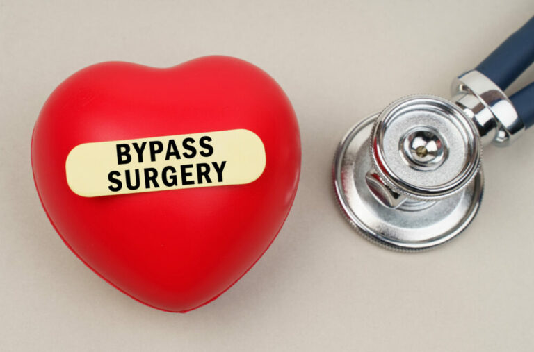 Gastric Bypass Surgery