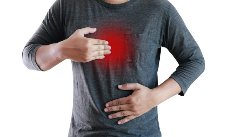 Nissen vs. Partial Fundoplication: Which GERD Surgery Is Right for You?